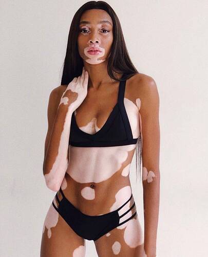 00-story-winnie-harlow-vs